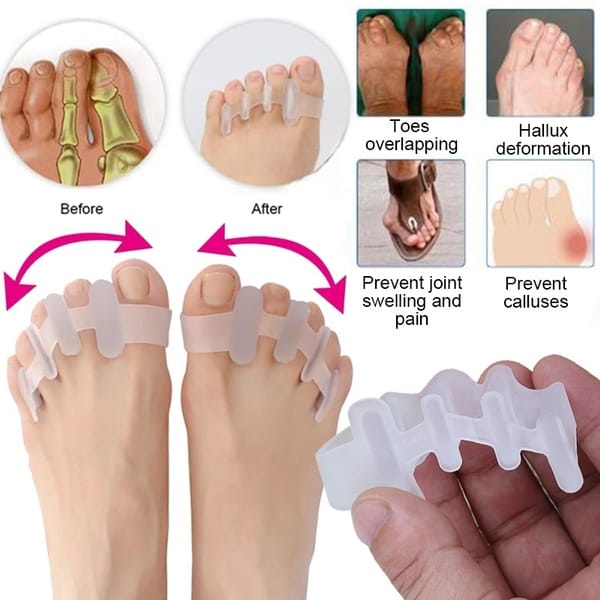 how to fix overlapping toes